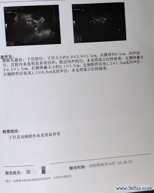 卵泡监测B超要测几次怎么知道卵了