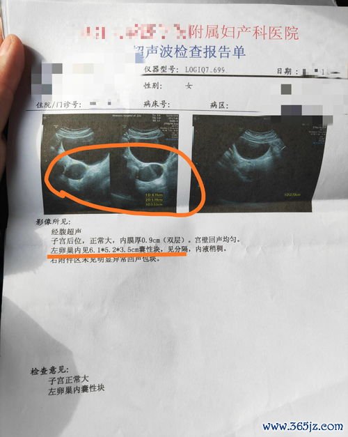 卵泡监测B超要测几次怎么知道卵了