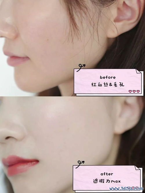 咯血：痰里带血丝别慌先分清是牙血还是肺血