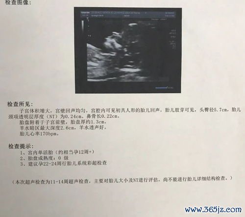 做试管婴儿医院怎么选，看资质看技术看成功率