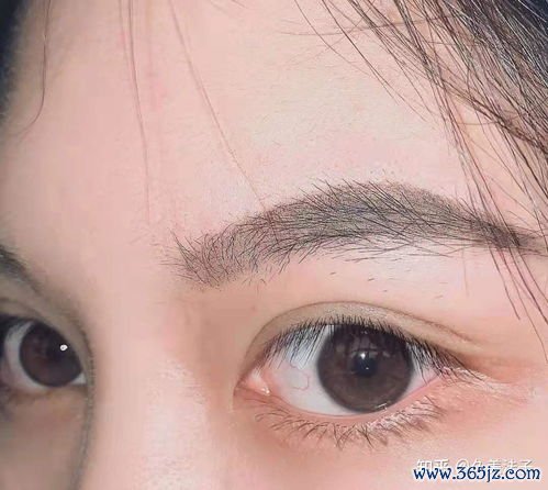 眼部整形医院排名前十：眼部整形医院与眼综合手术专家推荐