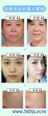 美容整形,中心,怎么,综合,医院