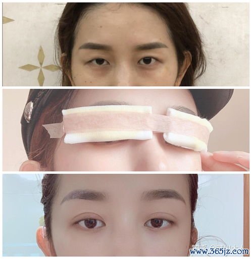 眼部,整形,医院,哪个,最好