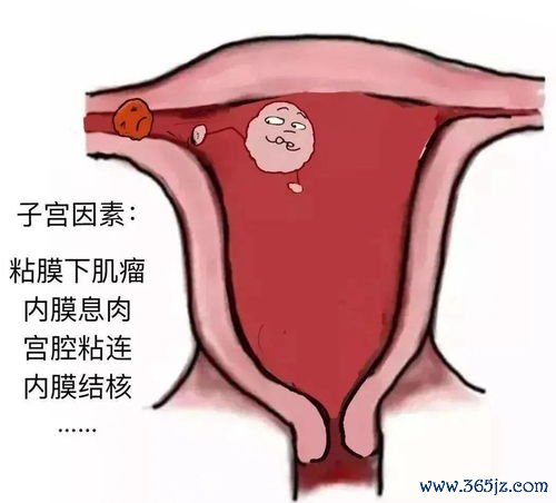 双子宫能正常怀孕吗两个子宫都能怀孕吗