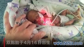 双角,子宫,容易,流产,怀孕