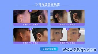 美容整形外科和皮肤科的区别：美容整形外科与皮肤美容科的治疗范围