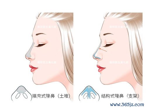 脸部整形手术方式：脸部整形与轮廓、五官精雕项目选择
