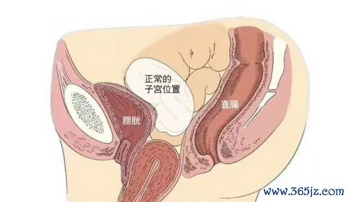 后壁脱垂便秘时加重有什么症状怎么治疗