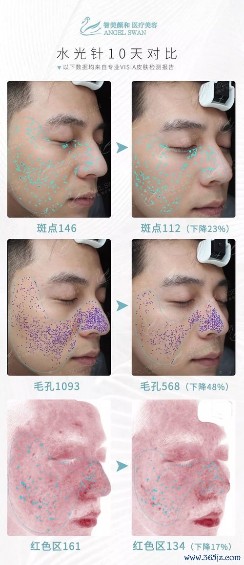 立方,整形,医院,怎么样,当地