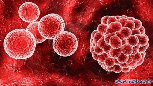 基底细胞癌：皮肤癌最常见，长这样