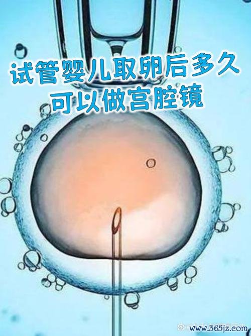 试管婴儿,多久