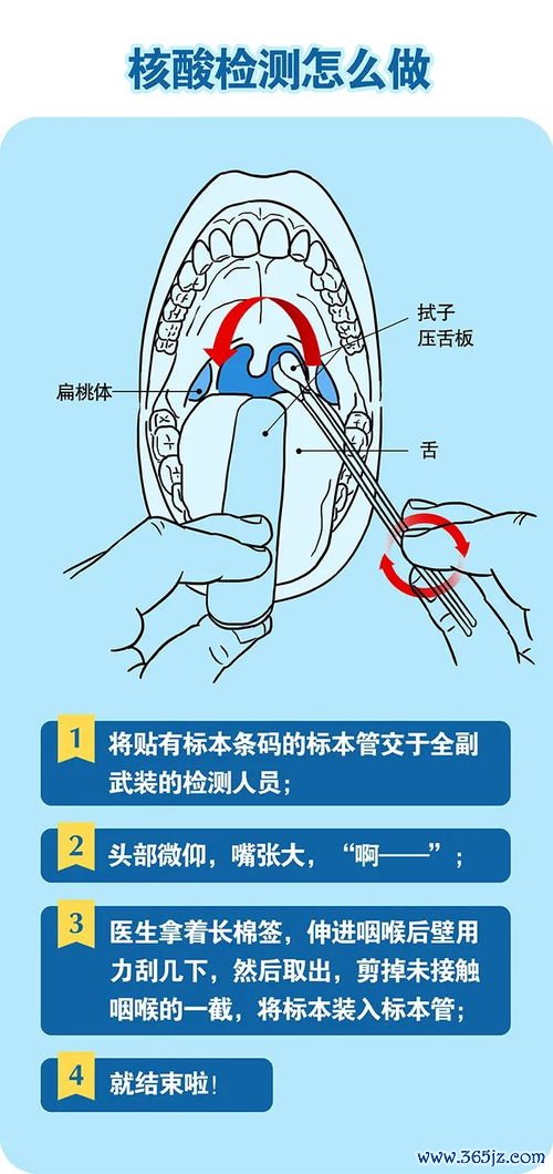 后壁脱垂有什么感觉