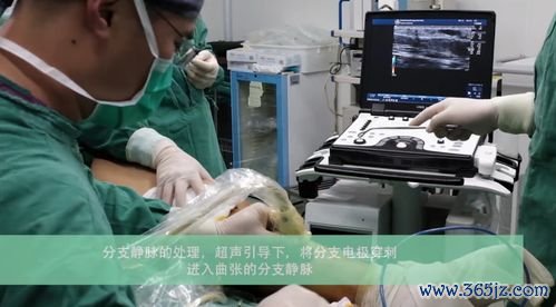 后装治疗是什么腔内放疗疼吗需要几次