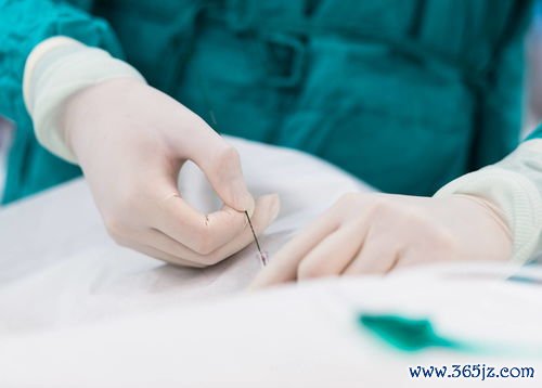 做试管婴儿好么