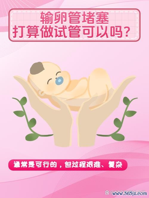 做试管婴儿好么