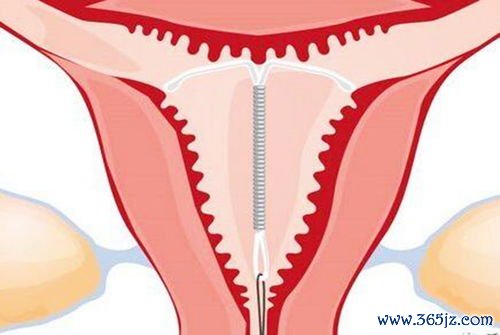 增殖期内膜有什么特点