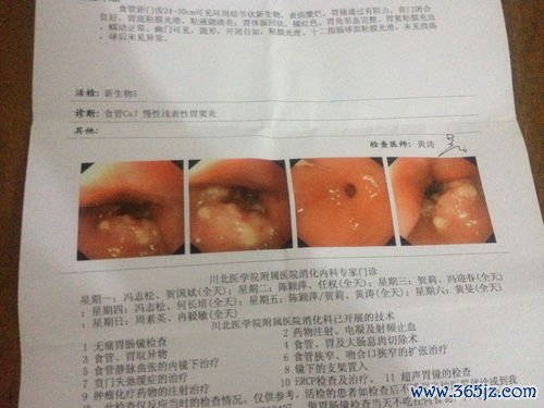 增殖期内膜有什么特点