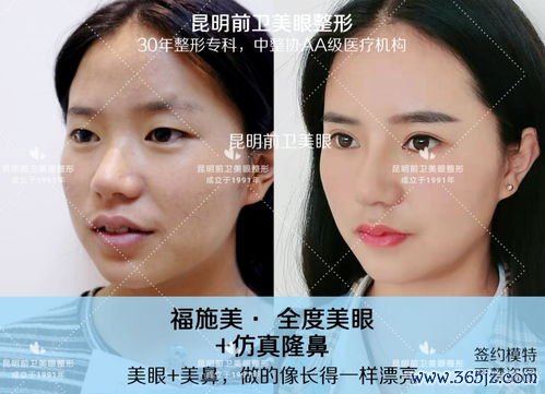 鼻子,整形,哪里,综合,修复