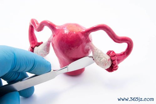 宫颈HPV：宫颈感染HPV，怎么转阴