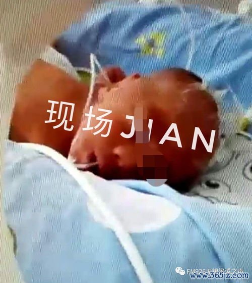 做试管婴儿很痛苦吗