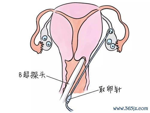 做试管婴儿得费用，国家补助政策