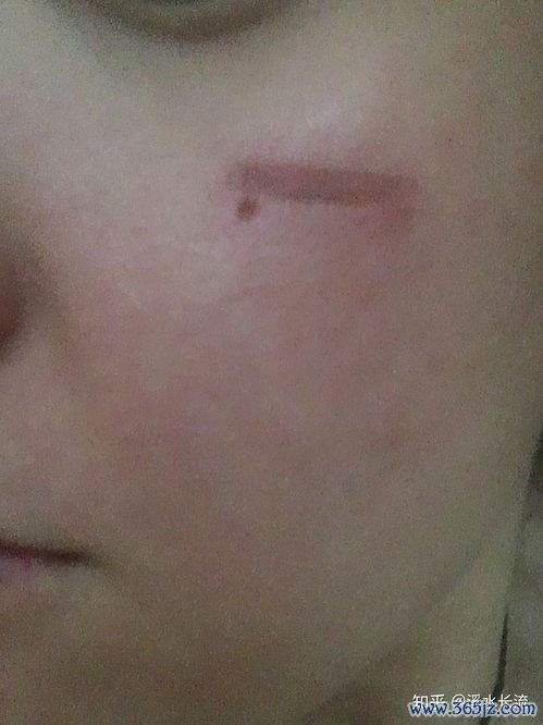 处女膜痕是什么样子的