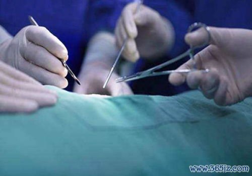 处女膜闭锁什么时候手术月经来潮前还是后