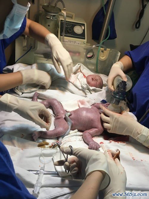 孕妇保健知识科普：孕妇保健与孕期产检营养运动全程指导