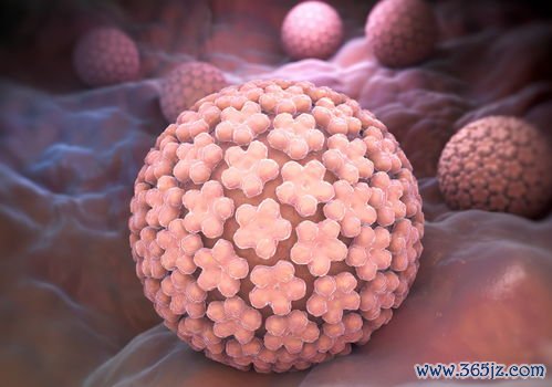 尖锐湿疣：菜花状疙瘩，HPV感染