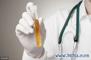 少尿,一天,尿量,少于,400ml