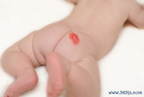 尿布疹：红屁股怎么护理