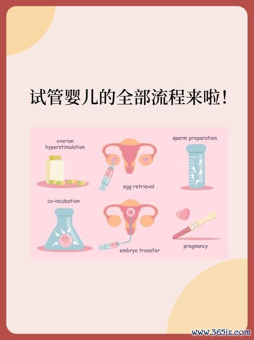 试管婴儿,流程