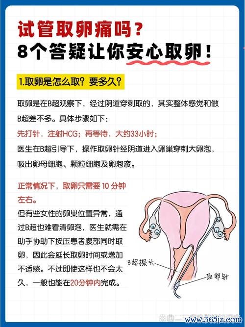 试管婴儿,疼吗