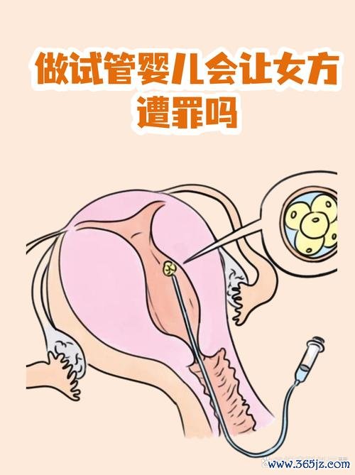 做试管婴儿痛苦吗