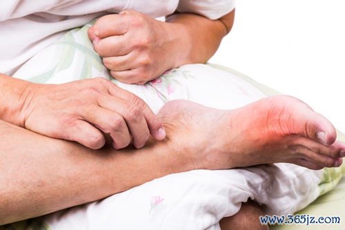 带状疱疹：腰上一圈泡，疼得要命