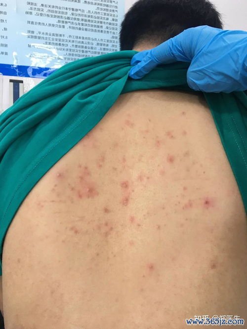 大两侧长小疙瘩是怎么回事