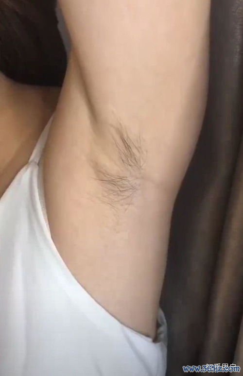 女性体毛重是什么原因需要查激素吗