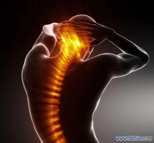 强直性脊柱炎：夜间腰痛晨起僵硬，年轻人多见