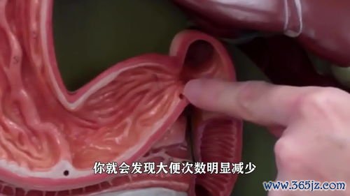 溃疡性,结肠炎,反复,发作,看看