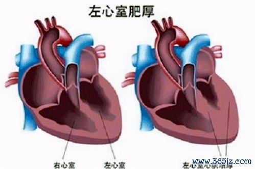 心脏彩超：心脏彩超看什么？EF值多少算正常？