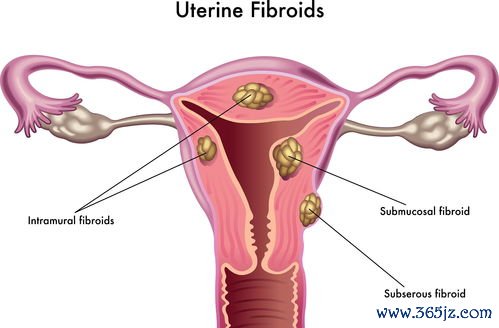 女性,子宫,保养,怎么,做能