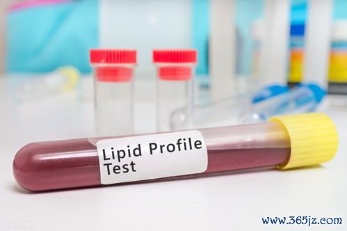 甘油,三酯,高吃,什么,怎么