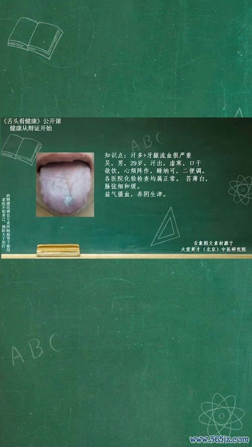 固表止汗牡蛎散，气虚自汗夜卧惊