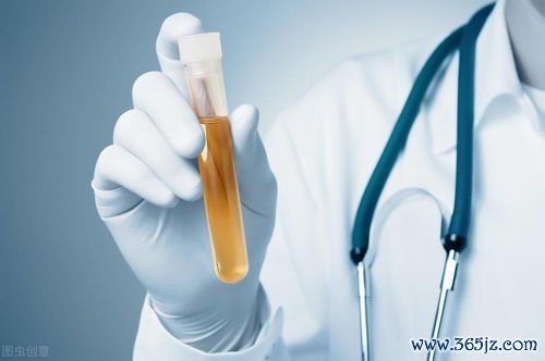 急性,损伤,肾功能,突然,下降