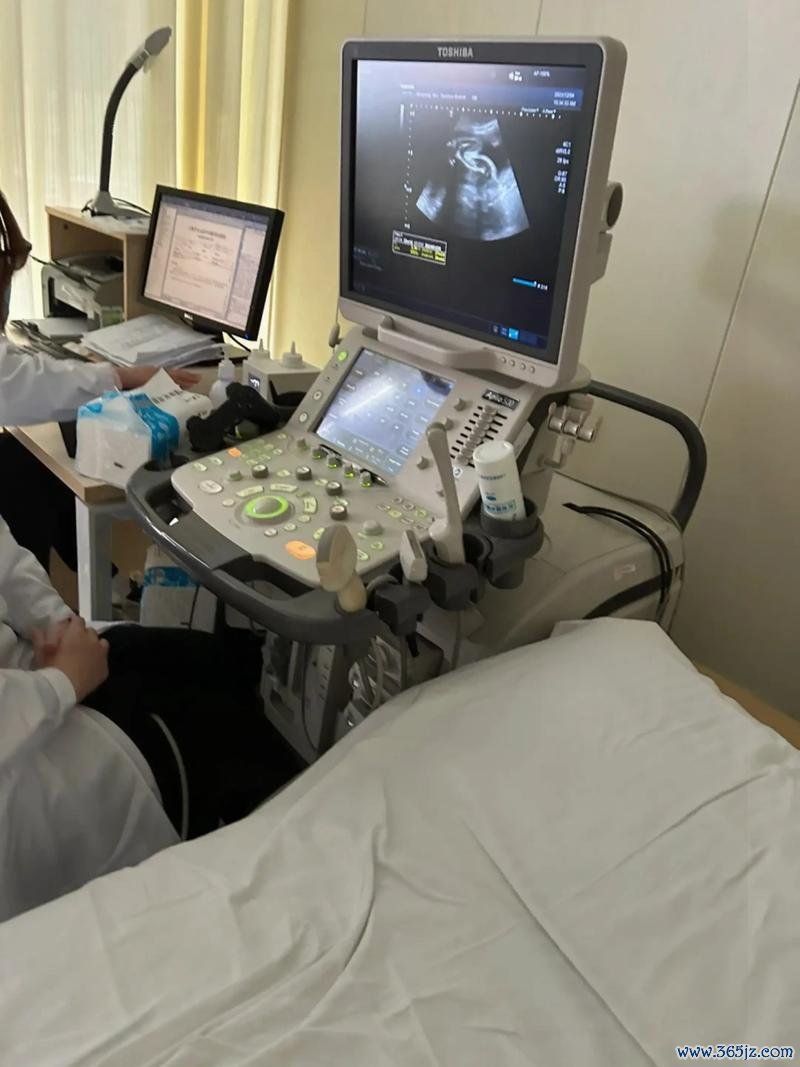 做试管婴儿要卧床多久