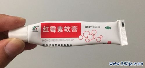 霉菌,性炎,什么,药好