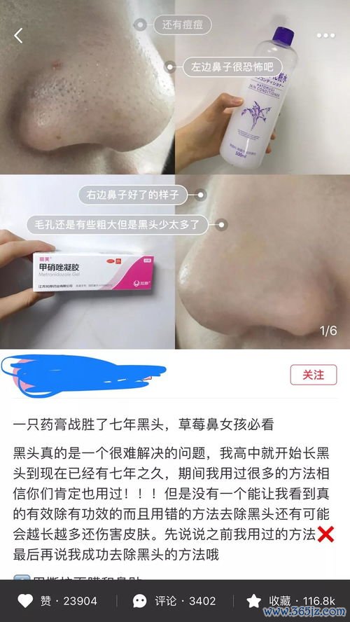 霉菌性炎用什么药好