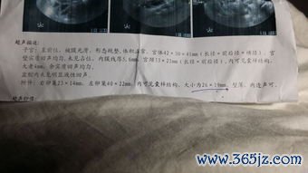 青春期,多囊,卵巢,怎么,理会