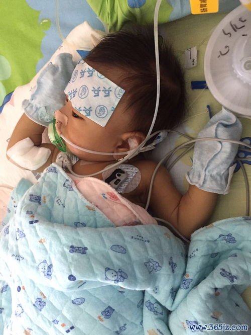 闭锁,什么时候,手术