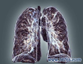 恶性黑色素瘤：痣变了，最危险的皮肤癌